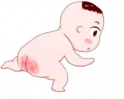春天穿紙尿褲容易出現紅屁屁，4招教你輕松搞定！